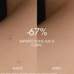 BiothermBiocorps                Sérum Anti-Imperfections