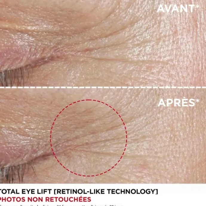 CLARINSTotal Eye Lift - Contour des Yeux Anti-Âge Soin yeux anti-rides Rechargeable