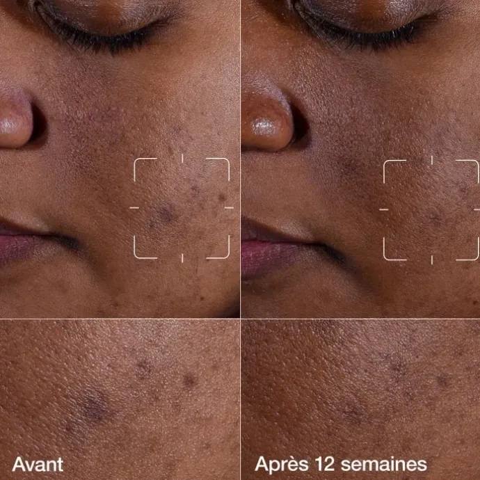 CLINIQUEEven Better Clinical™ Sérum Illuminateur Anti-taches