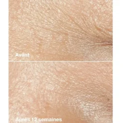 CLINIQUESmart Clinical Repair Crème Correctrice Anti-rides