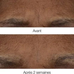 CLINIQUESmart Clinical Repair™ Baume Rétinoïde Anti-Rides