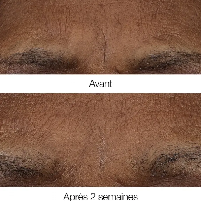 CLINIQUESmart Clinical Repair™ Baume Rétinoïde Anti-Rides