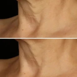 CLINIQUESmart Clinical Repair™ Crème Liftante Visage + Cou