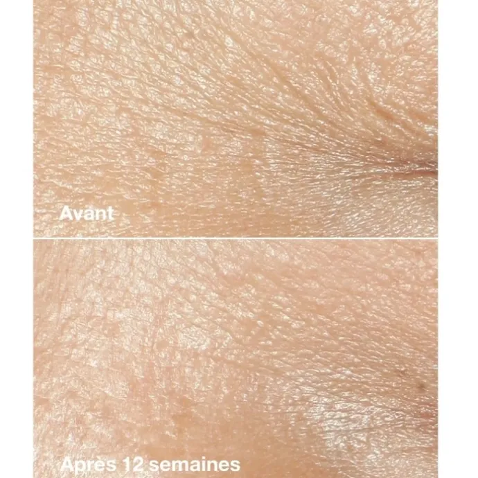CLINIQUESmart Clinical Repair Crème Riche Correctrice Anti-rides
