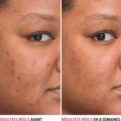 It CosmeticsBye Bye Dark Spots Sérum Anti-taches à la Niacinamide